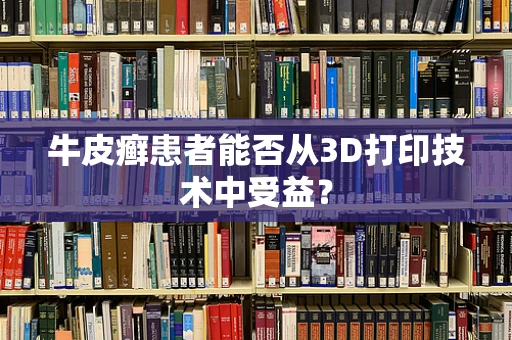 牛皮癣患者能否从3D打印技术中受益？