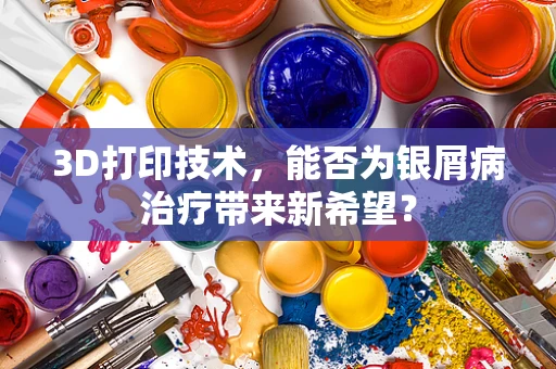 3D打印技术，能否为银屑病治疗带来新希望？